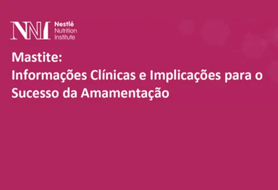 Mastite: Informações Clínicas e Implicações para o Sucesso da Amamentação Mastite: Informações Clínicas e Implicações para o Sucesso da Amamentação