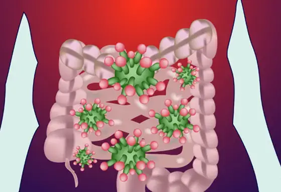 Manutenção de microbiomas: uma boa saúde intestinal pode combater o COVID-19 (news)
