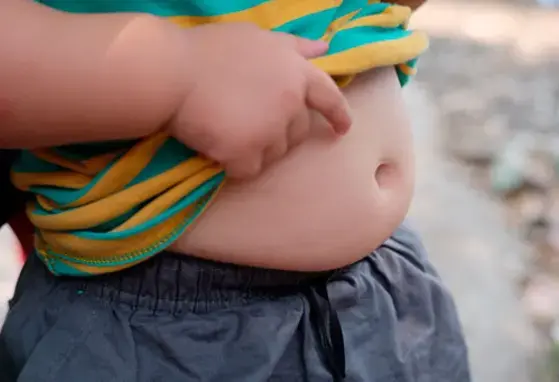 A obesidade infantil "é transmitida" com mais frequência pela mãe do que pelo pai: diz estudo (news)